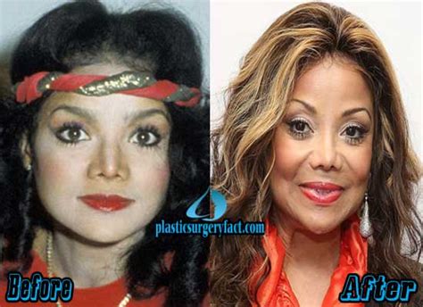 latoya jackson before plastic surgery|11 Celebrities Before And After Plastic Surgery